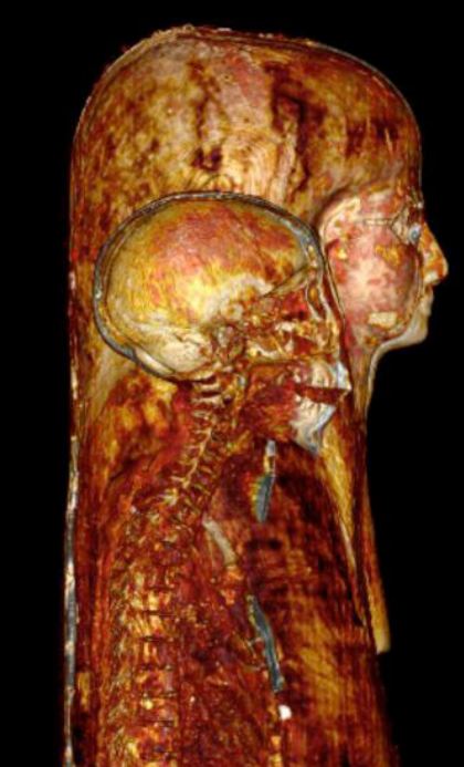 Mısır mumyası ilk kez böyle görüntülendi
