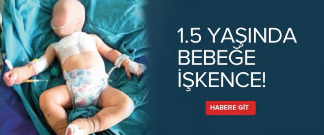 1.5 yaşında bebeğe işkence!