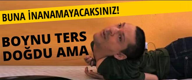 Buna inanamayacaksınız! Boynu ters doğdu