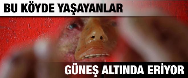 Bu köyde yaşayanlar güneş altında eriyor