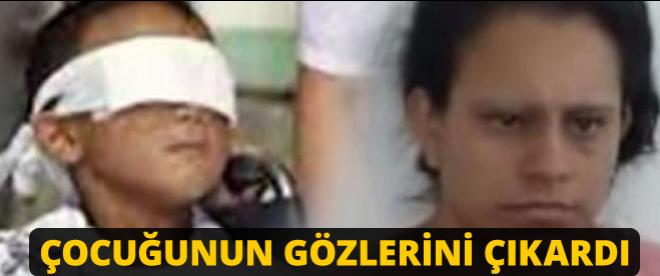 Çocuğunun gözlerini çıkardı