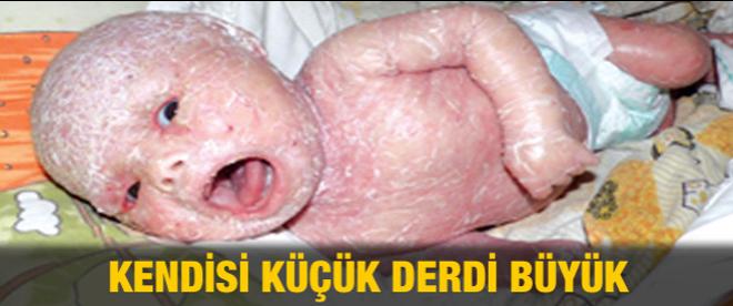 Kendisi küçük, derdi büyük