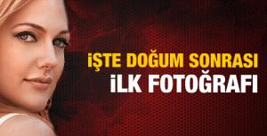 Doğum sonrası ilk fotoğraf