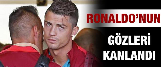 Ronaldonun gözleri kanlandı