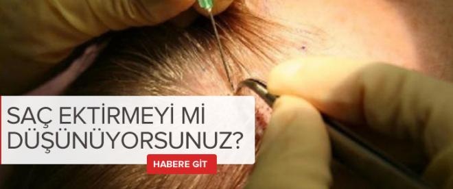 Saç ektirmeyi mi düşünüyorsunuz ?