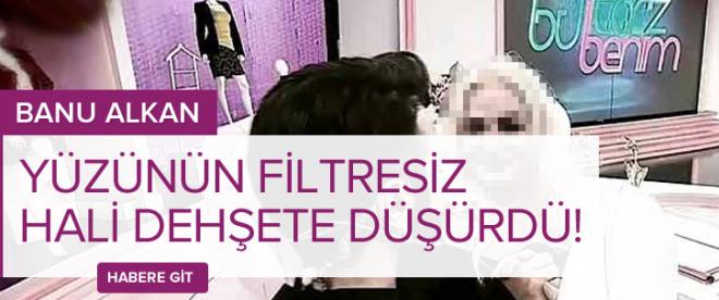 Banu Alkanın yüzünün filtresiz hali dehşete düşürdü!