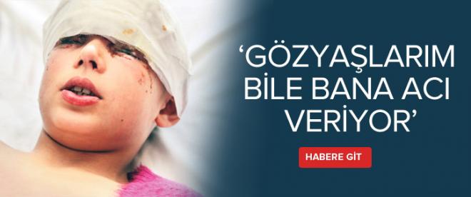 Gözyaşlarım bile bana acı veriyor