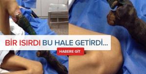 Yılan ısırdı bu hale geldi